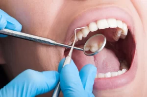 Checking patient teeth closely for any cavities